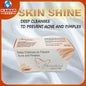 စကင်ရှိင်း - Skin Shine: Deep Cleanses To Prevent Acne and Pimples 002